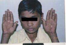 Reclaim Your Skin Confidence: A Journey to Healing Vitiligo & Psoriasis with Homeopathy