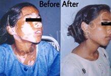 Recupera la Confianza en tu Piel: Un Viaje Hacia la Sanación del Vitíligo y la Psoriasis con Homeopatía